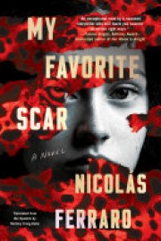 Nicolás Ferraro: My favorite scar 